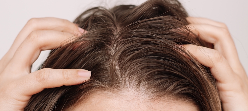 Saç yağlanması nasıl geçer? Yağlı saç neyin belirtisi olabilir?