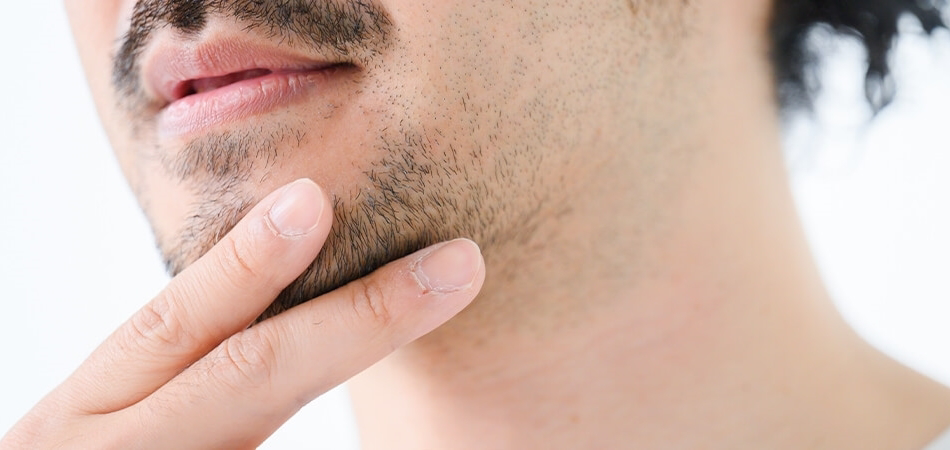 Sakal iltihabı neden olur? Sakal iltihabı nasıl geçer?