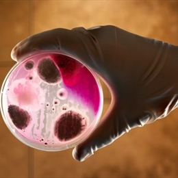 Şarbon Nedir ve Nasıl Bulaşır? Şarbon Hastalığı Belirtileri