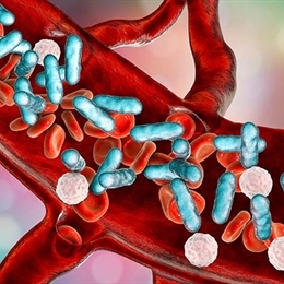 Sepsis