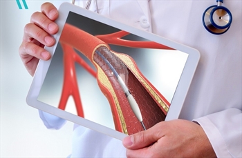 Şah Damarı Tıkanıklıkları