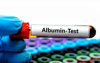 Serum albumin düşüklüğünde ne yemeli? Serum albumin düşüklüğü neden olur?