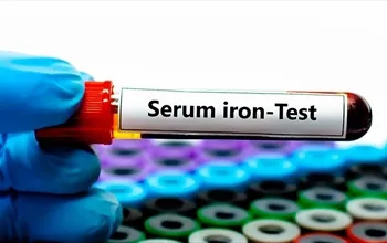 Serum demir nedir, düşüklüğü ve yüksekliği ne anlama gelir?