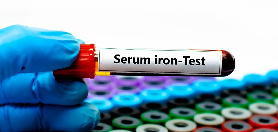 Serum demir nedir, düşüklüğü ve yüksekliği ne anlama gelir?