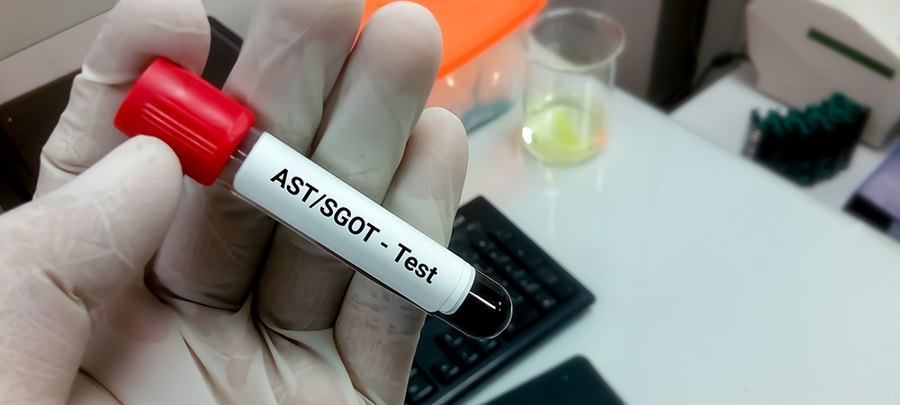 SGOT (AST) ve SGPT (ALT) değerleri neyi ölçer? SGOT AST kaç olursa tehlikeli?