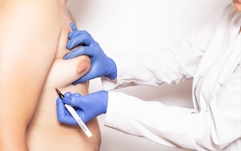 Erkeklerde Jinekomasti Sık Görülebiliyor