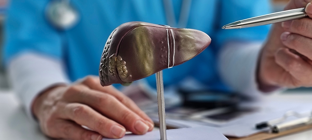 Siroz neden olur? Siroz hastalığı iyileşir mi?