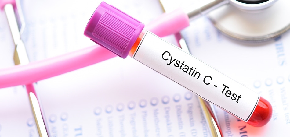 Sistatin C nedir? Böbrek fonksiyonunda neden önemlidir?