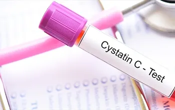Sistatin C nedir? Böbrek fonksiyonunda neden önemlidir?