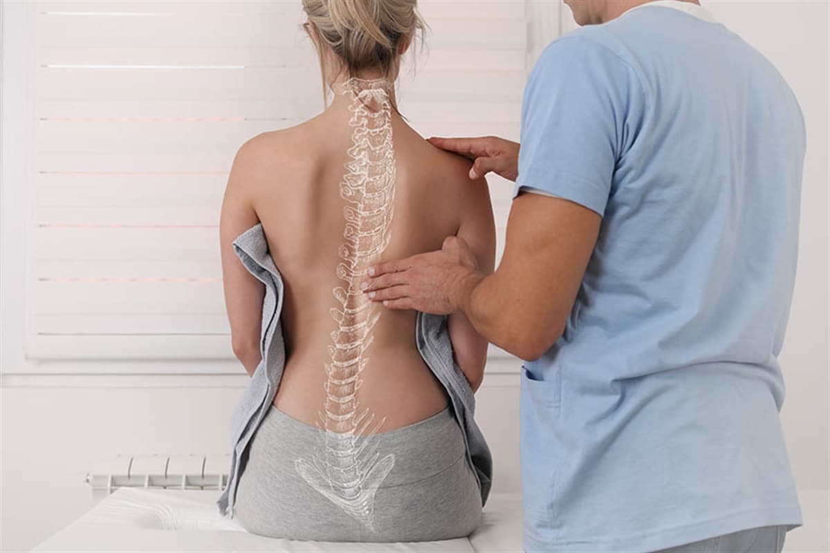 Skolyoz Nedir? Skolyoz Hastalığı Belirtileri ve Tedavisi