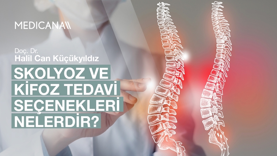 Skolyoz ve Kifoz Tedavi Seçenekleri Nelerdir?