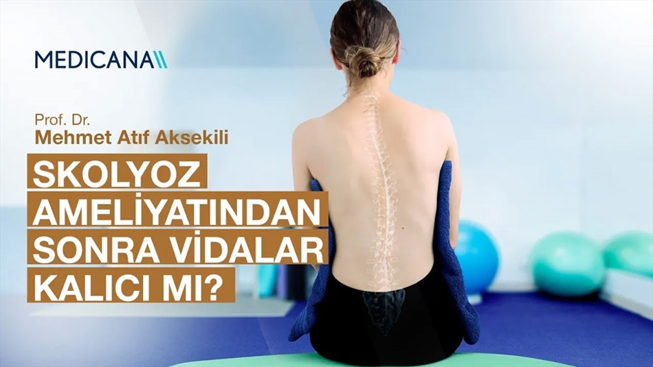 Skolyoz Ameliyatı Sonrasında Vidalar Çıkarılmalı mıdır?