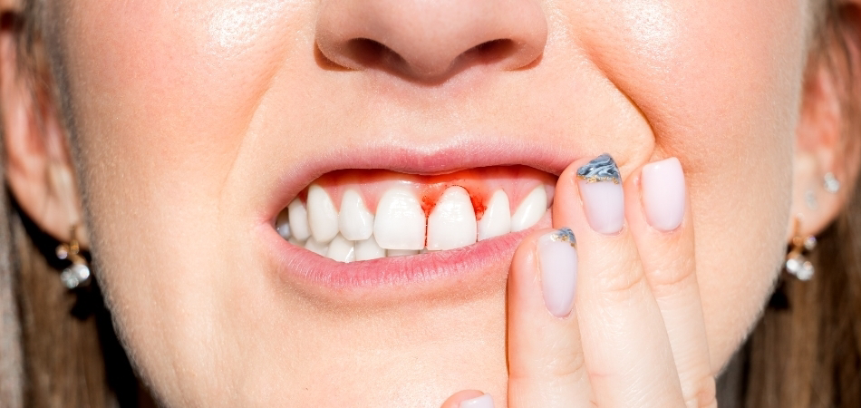 Skorbüt hastalığı nedir? Skorbüt belirtileri nelerdir?