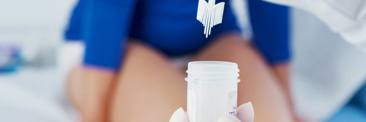 Smear Testi