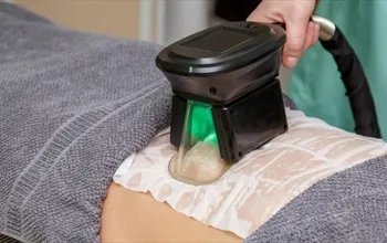 Soğuk lipoliz nedir? Soğuk lipoliz nasıl uygulanır?