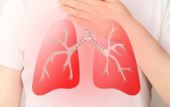 Solunum yetmezliği türleri nelerdir? Tip 1, Tip 2, Tip 3 ve Tip 4 sınıflaması