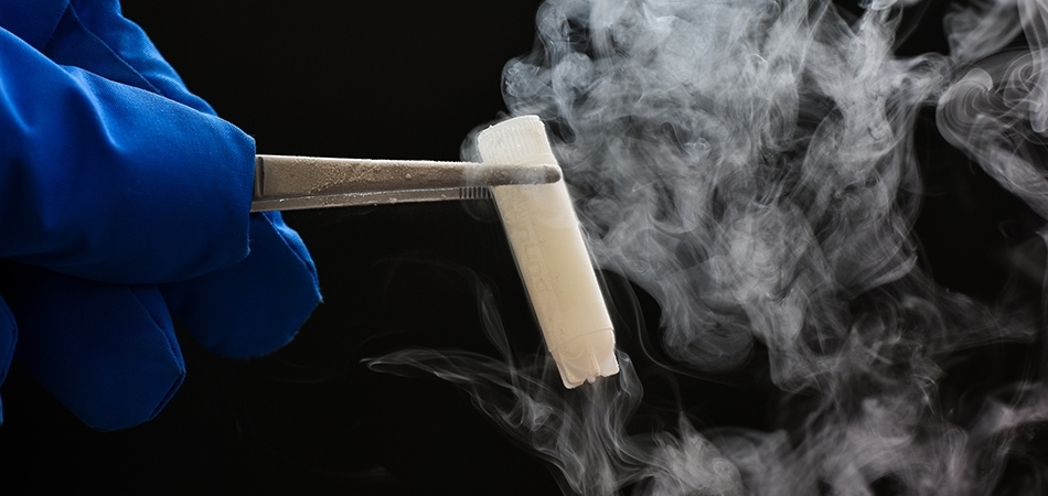 Sperm dondurma nasıl yapılır? Sperm dondurma işlemi nerede yapılır?