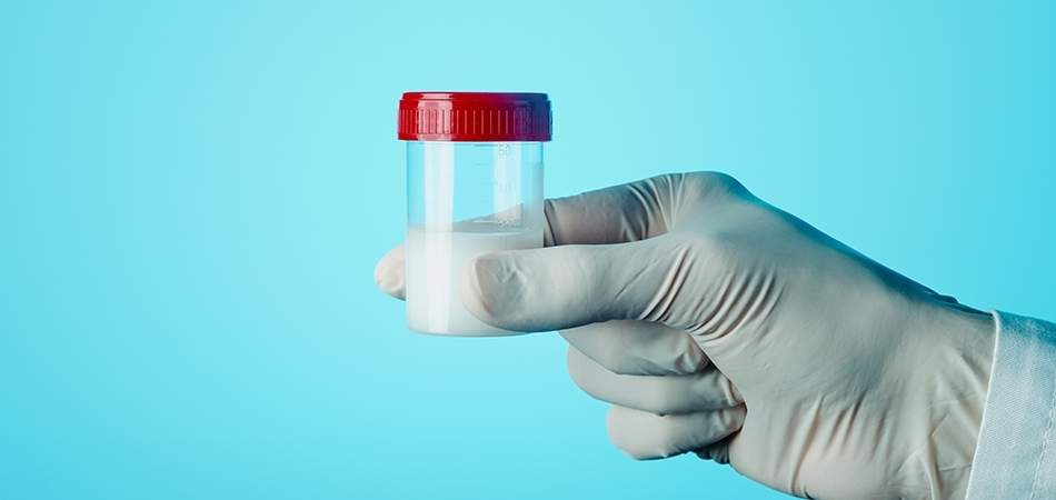 Sperm testi nedir? Sperm testi nasıl yapılır?