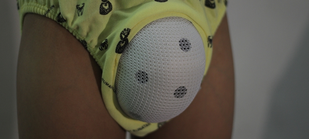 Sünnet nasıl yapılır? Sünnet sağlıklı mıdır?