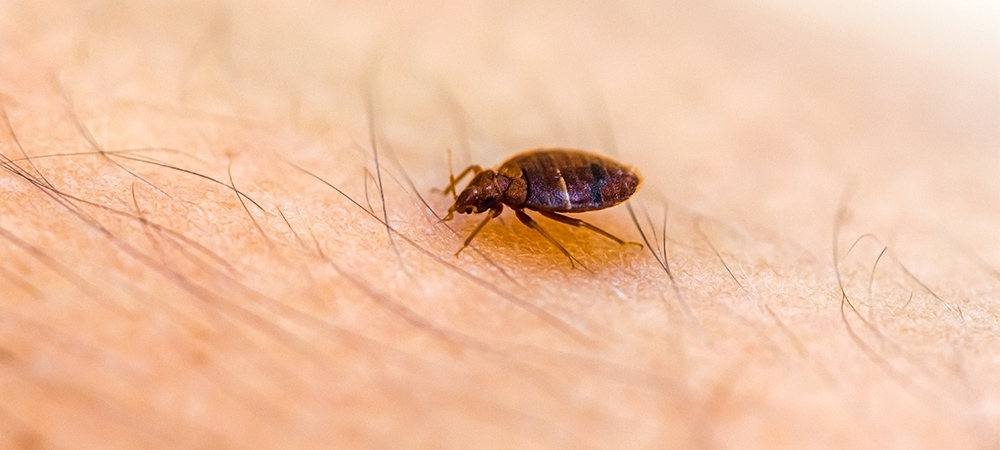 Tahtakurusu ısırığı belirtileri nelerdir? Tahtakurusu ısırığına ne iyi gelir?