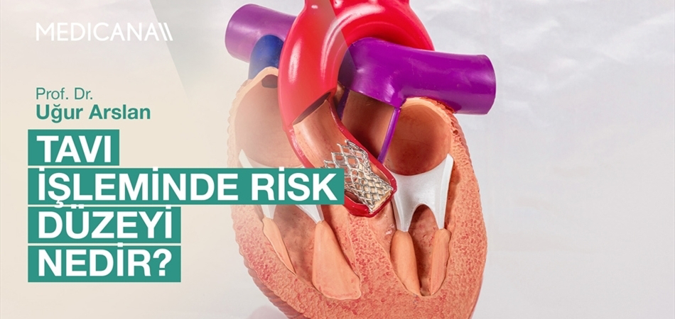 TAVI İşleminde Risk Düzeyi Nedir?