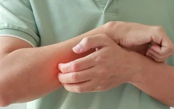 Temre nedir? Temre belirtileri nelerdir?