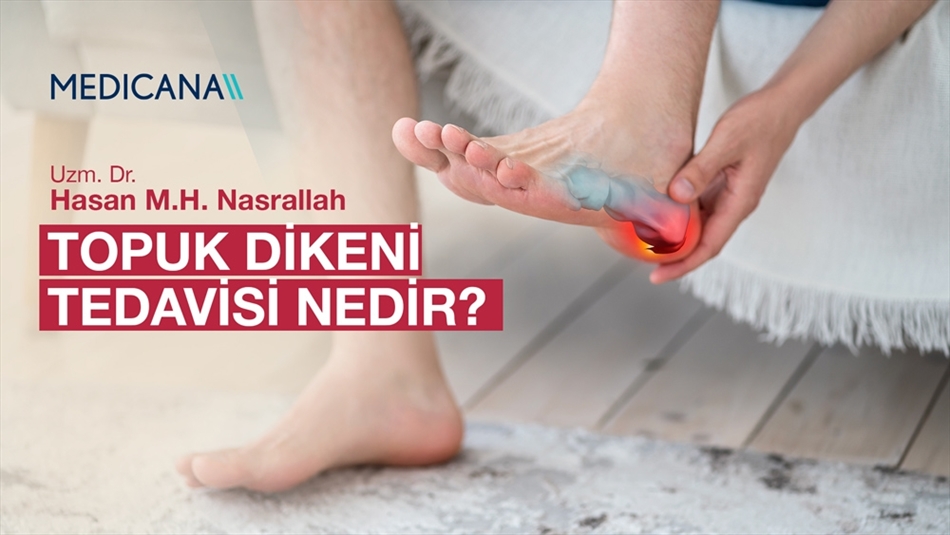Topuk Dikeni Tedavisi Nedir?