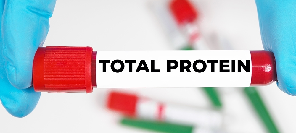 Total protein neyi gösterir? Total protein kaç olmalı?