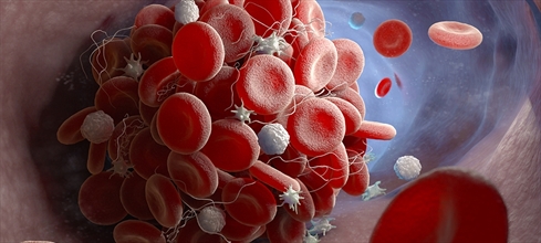 Trigliserid nedir? Trigliserid yüksekliği/ düşüklüğü ne anlama gelir?