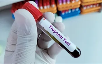 Troponin nedir, yüksekliği ne anlama gelir?