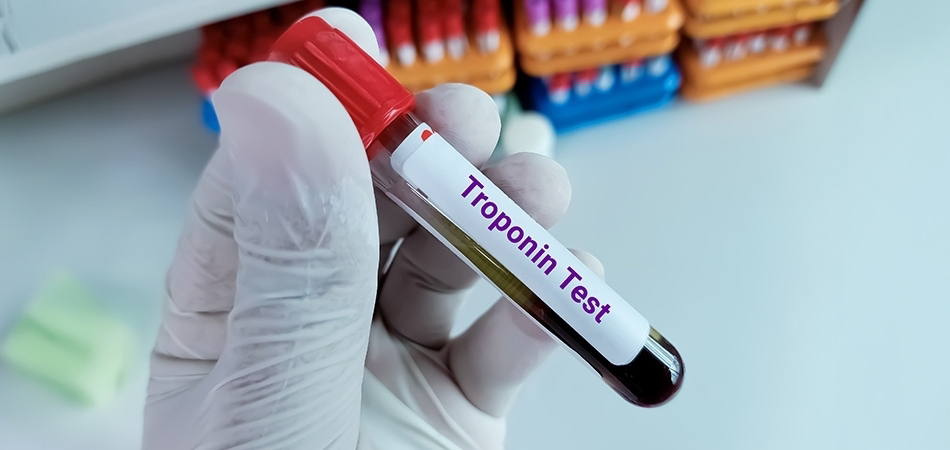 Troponin nedir, yüksekliği ne anlama gelir?