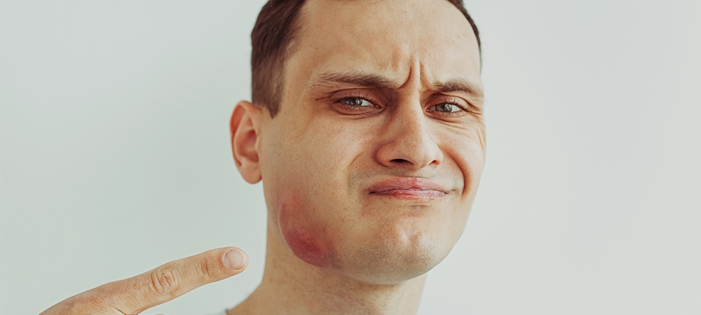 Tükürük bezi şişmesi neden olur? Tükürük bezi şişmesinin belirtileri neler?