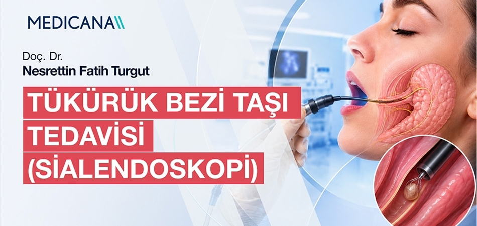 Tükürük Bezi Taşı Tedavisi (Sialendoskopi)