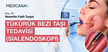 Tükürük Bezi Taşı Tedavisi (Sialendoskopi)