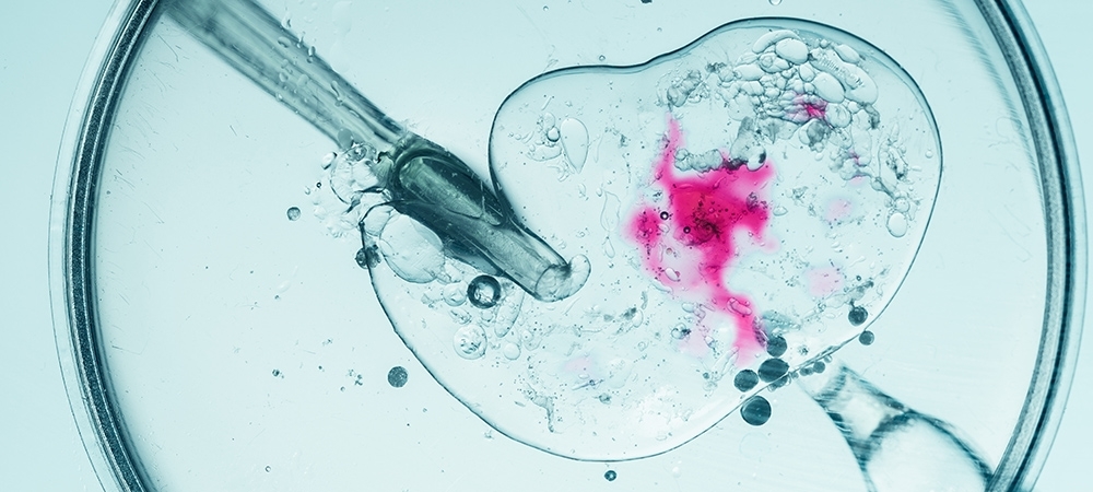 Tüp bebek nedir? Tüp bebek nasıl olur?