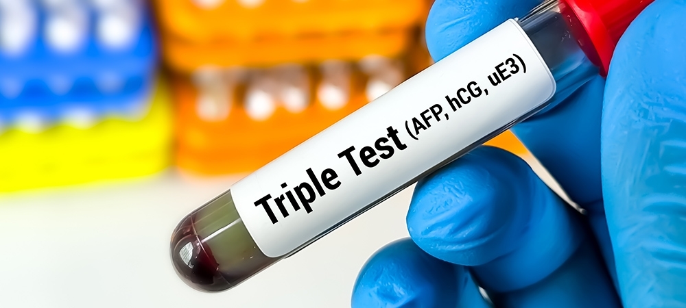 Üçlü tarama testi ne zaman yapılır? Üçlü tarama testinde neye bakılır?