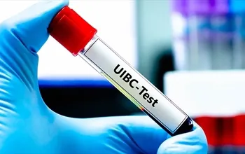 UIBC (Unsaturated Iron Binding Capacity): Nedir, nasıl yorumlanır ve ne zaman istenir?