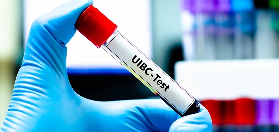 UIBC (Unsaturated Iron Binding Capacity): Nedir, nasıl yorumlanır ve ne zaman istenir?