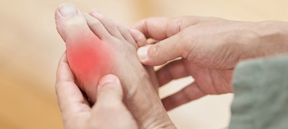 Ürik asit nedir? Ürik asit yüksek/düşük olursa ne olur?