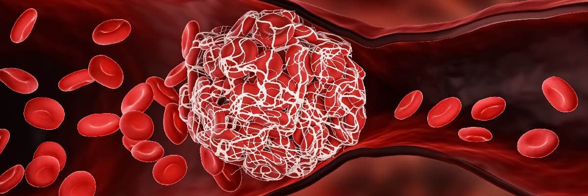 Vampir Hastalığı Porfiria Nedir?
