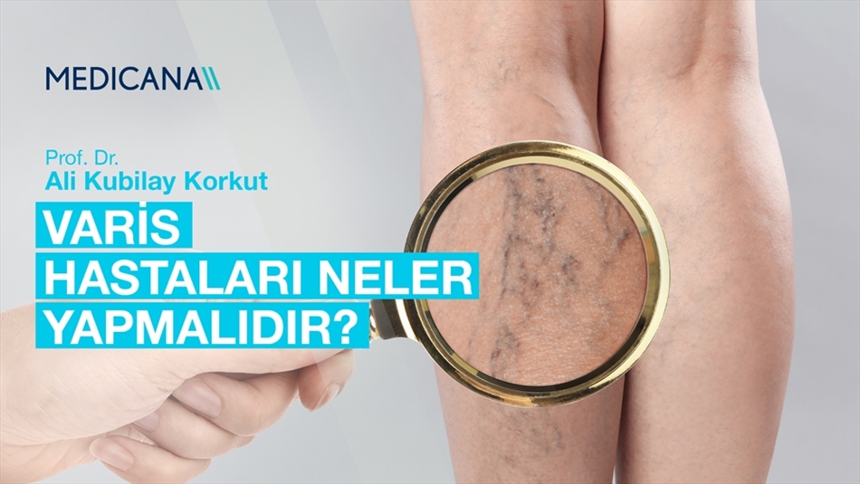 Varis Hastaları Neler Yapmalıdır?
