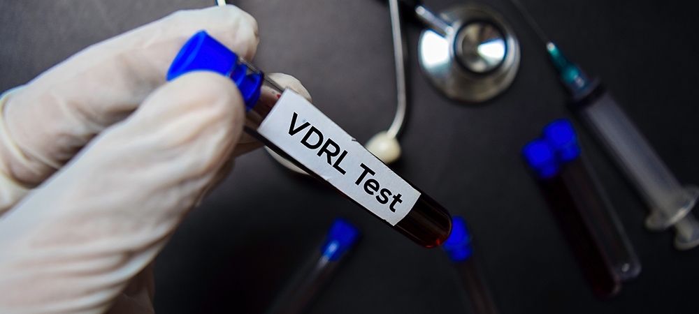 VDRL testi nedir? VDRL testi neden yapılır?