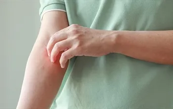 Vücut neden kaşınır? Vücut kaşıntısı neyin belirtisidir?