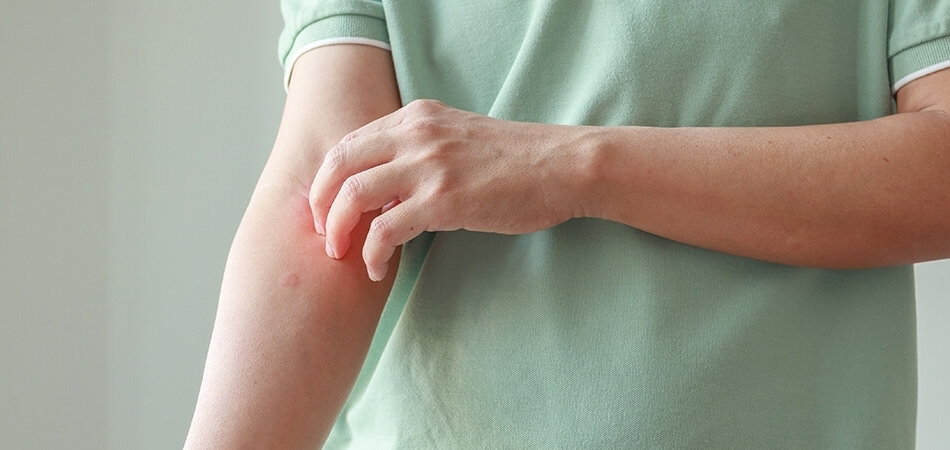 Vücut neden kaşınır? Vücut kaşıntısı neyin belirtisidir?