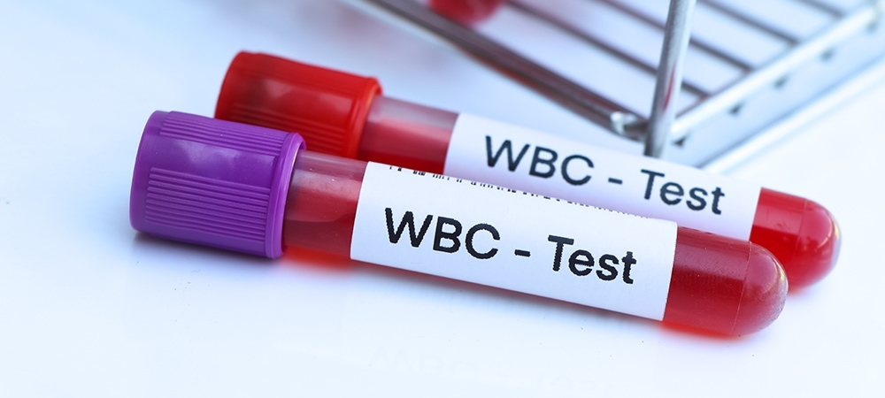 WBC nedir? WBC yüksekliği ne anlama gelir?