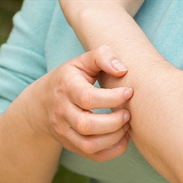 Sivrisinek Isırığına (Kaşıntısına) Ne İyi Gelir & Nasıl Geçer?