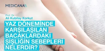 Yaz Döneminde Karşılaşılan Bacaklardaki Şişliğin Sebepleri Nelerdir?