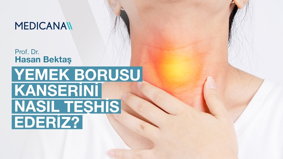 Yemek Borusu Kanserini Nasıl Teşhis Ederiz?