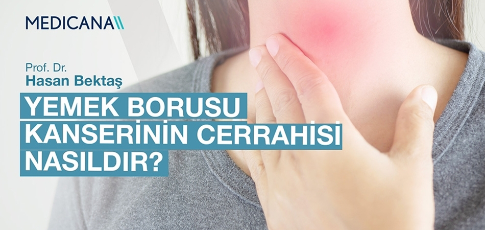 Yemek Borusu Kanserinin Cerrahisi Nasıldır?