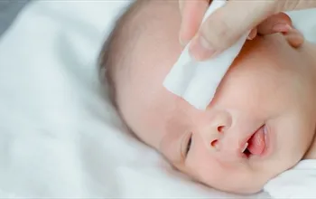 Yenidoğan göz akıntısı neden olur? Bebeklerde göz akıntısı nasıl geçer?